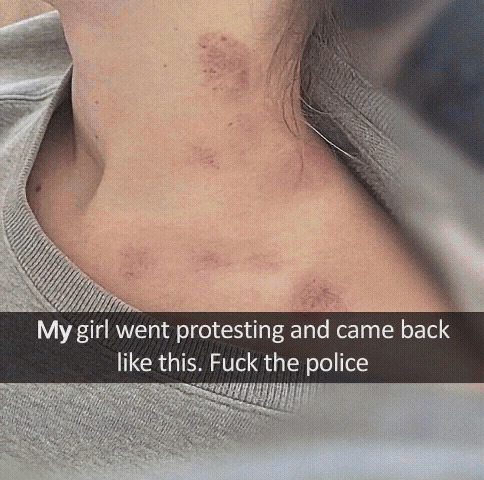 Fuck police brutality