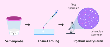 eosin-test.png