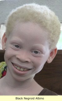 Albino_1.jpg