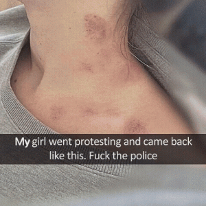 Fuck police brutality